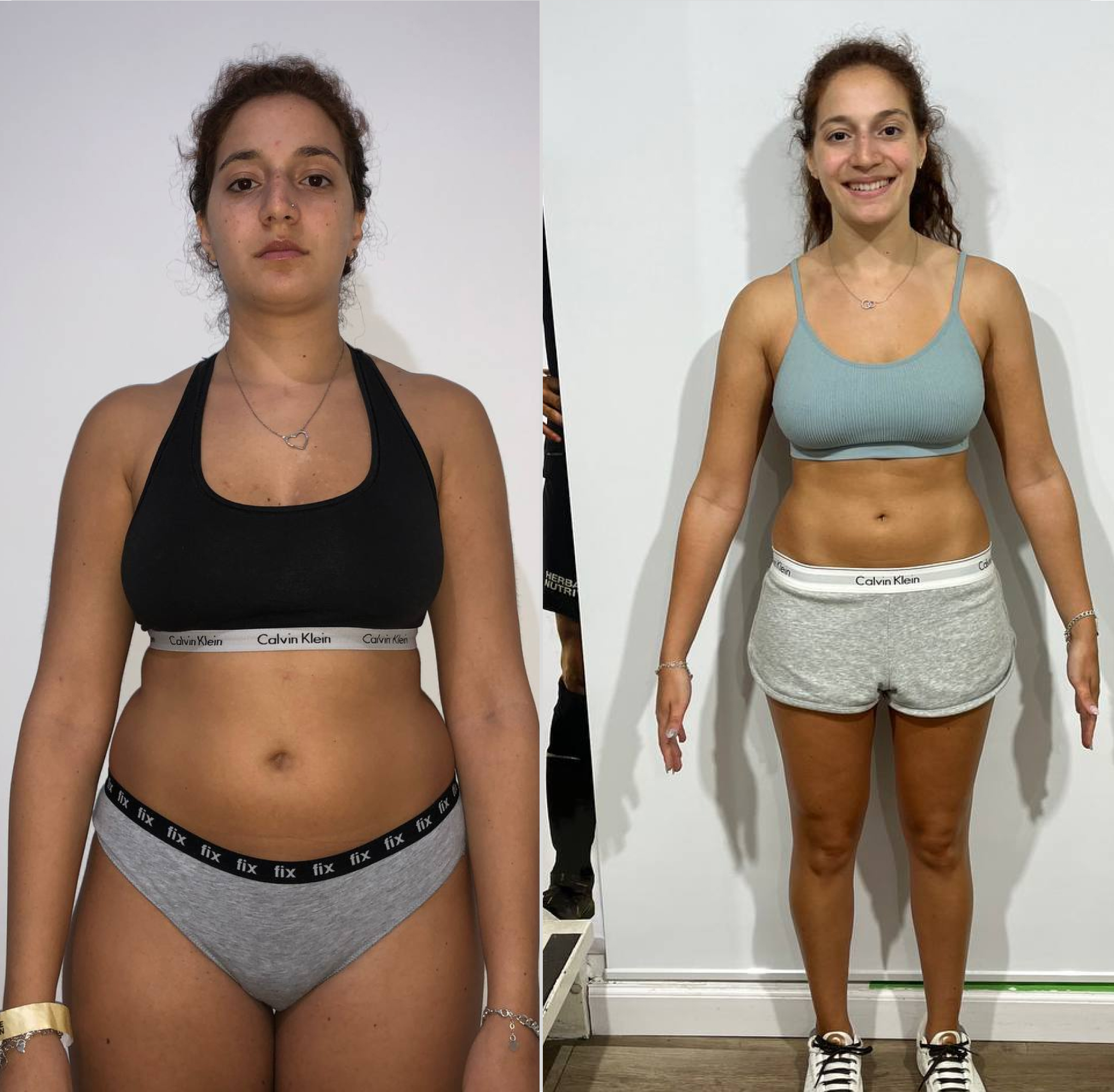 Before and after photo of Noy